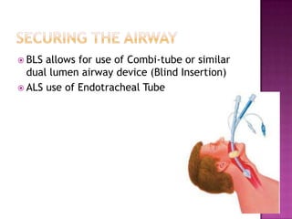  BLS allows for use of Combi-tube or similar
  dual lumen airway device (Blind Insertion)
 ALS use of Endotracheal Tube
 