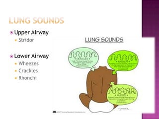  Upper   Airway
    Stridor


 Lower   Airway
    Wheezes
    Crackles
    Rhonchi
 