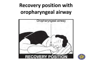 airway assesement.pptx