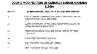 GRADE LARYNGOSCOPIC VIEW WITH RIGID LARYNGOSCOPE
1 GLOTTIC OPENING CLEARLY VISUALIZED,POSTERIOR COMISSURE AND
ENTIRE LENGTH OF VOCAL CORDS SEEN
2A GLOTTIC OPENING PARTLY VISUALIZED,POSTERIOR COMISSURE AND
PART OF BOTH VOCAL CORD VISIBLE
2B POSTERIOR COMISSURE VISUALIZED BUT NO PORTION OF VOCAL
CORDS SEEN
3A ONLY EPIGLOTTIS VISUALIZED,LIFTABLE
3B ONLY EPIGLOTTIS VISUALIZED,NOT LIFTABLE
4 ONLY THE ROOT OF TONGUE VISUALIZED
COOK’S MODIFICATION OF CORMACK LEHANE GRADING
(1999)
 