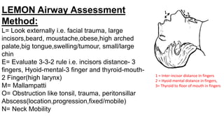 LEMON Airway Assessment
Method:
L= Look externally i.e. facial trauma, large
incisors,beard, moustache,obese,high arched
palate,big tongue,swelling/tumour, small/large
chin
E= Evaluate 3-3-2 rule i.e. incisors distance- 3
fingers, Hyoid-mental-3 finger and thyroid-mouth-
2 Finger(high larynx)
M= Mallampatti
O= Obstruction like tonsil, trauma, peritonsillar
Abscess(location,progression,fixed/mobile)
N= Neck Mobility
1 = Inter-incisor distance In fingers
2 = Hyoid mental distance in fingers,
3= Thyroid to floor of mouth in fingers
 