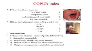 Airway assesment IN ANESTHESIA 