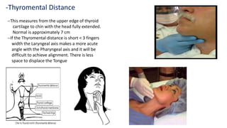 --This measures from the upper edge of thyroid
cartilage to chin with the head fully extended.
Normal is approximately 7 cm
--If the Thyromental distance is short < 3 fingers
width the Laryngeal axis makes a more acute
angle with the Pharyngeal axis and it will be
difficult to achieve alignment. There is less
space to displace the Tongue
-Thyromental Distance
 