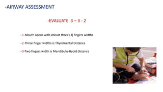 --1-Mouth opens with atleast three (3) fingers widths
--2-Three finger widths is Thyromental Distance
--3-Two fingers width is Mandibulo-Hyoid distance
-EVALUATE 3 – 3 - 2
-AIRWAY ASSESSMENT
 