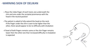 ---Place the index finger of each hand, one underneath the
chin and one under the occipital prominence with the
head in the neutral position
--The patient is asked to fully extend the head on the neck.
If the finger under the chin is seen to be higher than the
other, there would appear to be no difficulty with intubation
--If level of both fingers remains same or the chin finger remains
lower then the other one than increased difficulty in intubation
is expected
-WARNING SIGN OF DELIKAN
 