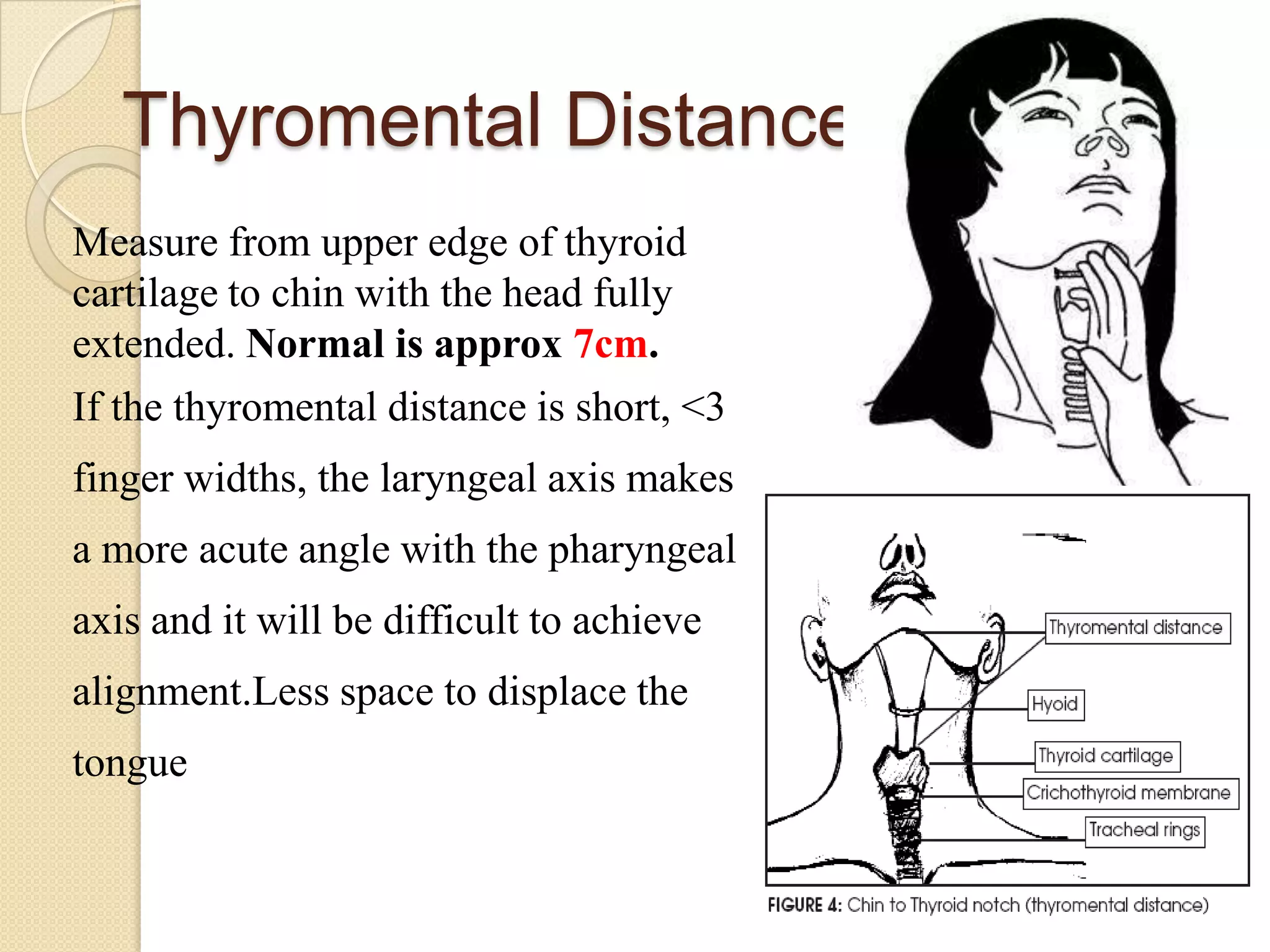 Thyromental Distance
Measure from upper edge of thyroid
cartilage to chin with the head fully
extended. Normal is approx 7cm.
If the thyromental distance is short, <3
finger widths, the laryngeal axis makes
a more acute angle with the pharyngeal
axis and it will be difficult to achieve
alignment.Less space to displace the
tongue
 