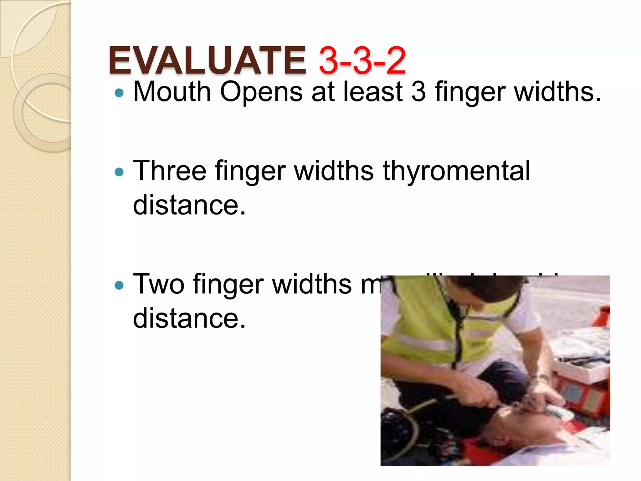 EVALUATE 3-3-2
   Mouth Opens at least 3 finger widths.

   Three finger widths thyromental
    distance.

   Two finger widths mandibulohyoid
    distance.
 