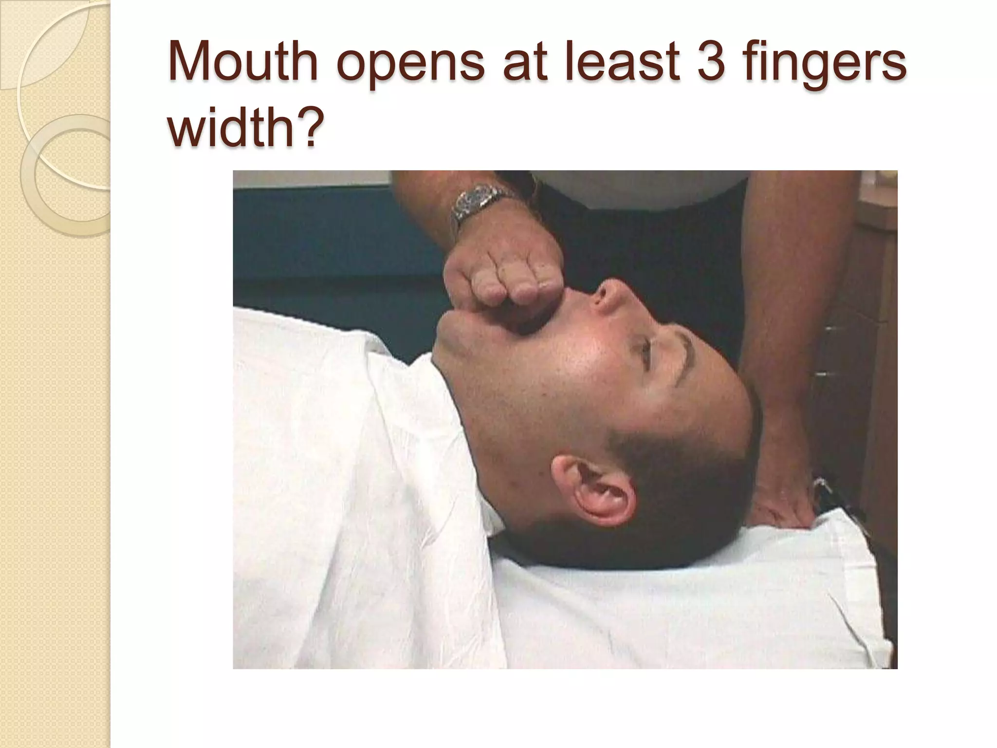 Mouth opens at least 3 fingers
width?
 