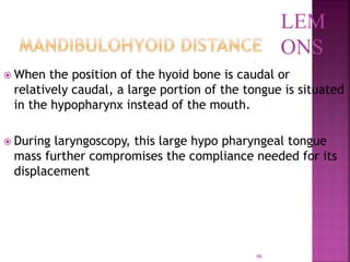 46
 When the position of the hyoid bone is caudal or
relatively caudal, a large portion of the tongue is situated
in the hypopharynx instead of the mouth.
 During laryngoscopy, this large hypo pharyngeal tongue
mass further compromises the compliance needed for its
displacement
LEM
ONS
 
