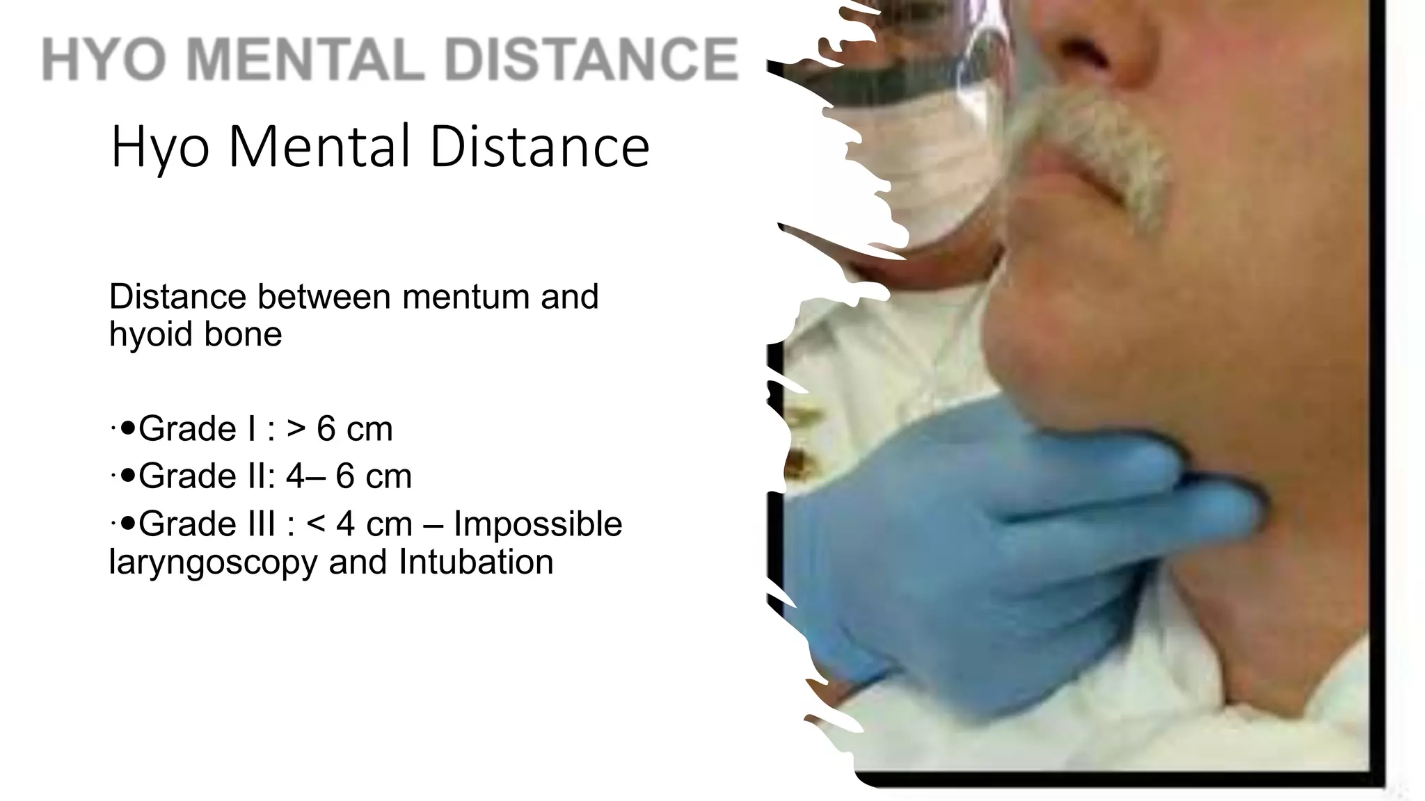 airway assessment.pptx