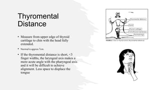 airway assessment.pptx