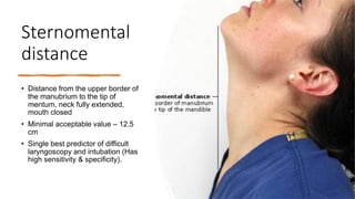 airway assessment.pptx