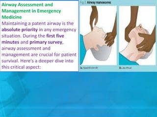 Airway Assessment and
Management in Emergency
Medicine
Maintaining a patent airway is the
absolute priority in any emergency
situation. During the first five
minutes and primary survey,
airway assessment and
management are crucial for patient
survival. Here's a deeper dive into
this critical aspect:
 