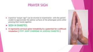 PRAYER SIGN
 A positive “prayer sign” can be elicited on examination with the patient
unable to approximate the palmar surfaces of the phalangeal joints while
pressing their hands together.
 SEEN IN DIABETES.
 It represents cervical spine immobility & a potential for a difficult
intubation [ STIFF JOINT SYNDROME IN JUVENILE DIABETES ]
 