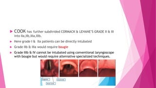  COOK has further subdivided CORMACK & LEHANE’S GRADE II & III
into IIa,IIb,IIIa,IIIb.
 Here grade I & IIa patients can be directly intubated
 Grade IIb & IIIa would require bougie
 Grade IIIb & IV cannot be intubated using conventional laryngoscope
with bougie but would require alternative specialized techniques.
 