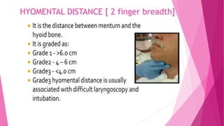 Hyomental Distance