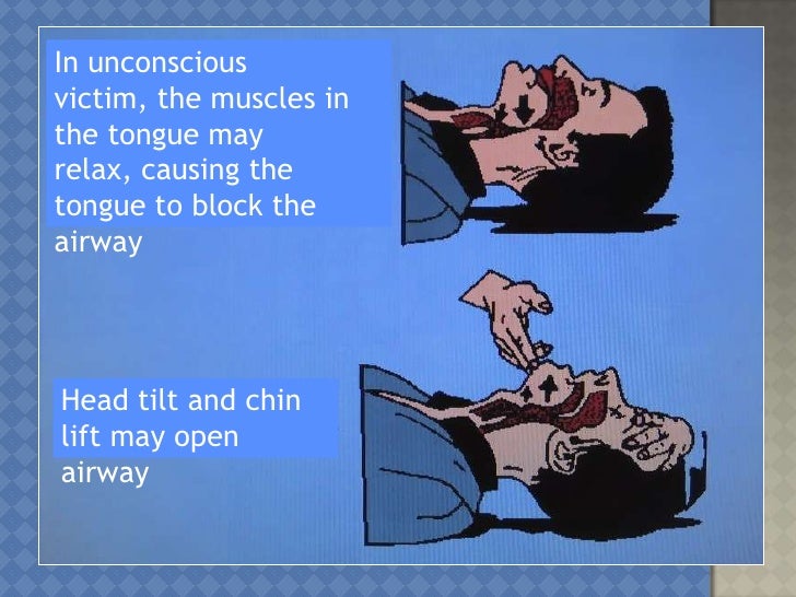 Airway, Breathing dan Circulation (ABC)