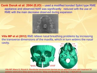 Airway considerations in orthodontics - shobitha.ppt