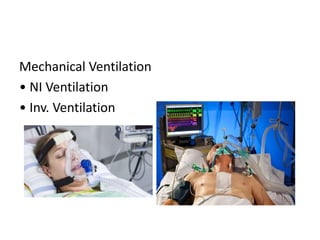Mechanical Ventilation
• NI Ventilation
• Inv. Ventilation
 