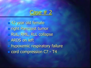 Case # 2
 42 year old female
 right Pancoast tumor
 RUL, RML, RLL collapse
 ARDS on left
 hypoxemic respiratory failure
 cord compression C7 - T4
 