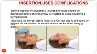 INSERTION,USES,COMPLICATIONS
15
During insertion Pharyngeal & laryngeal reflexes should be
depressed before an oral airway is inserted, to avoid coughing &
laryngospasm.
Selecting the correct size is important. Correct size is estimated by
holding the airway next to pts mouth with the tip at the angle of
mandible.
 