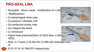 PRO-SEAL LMA
54
 Reusable , silicon made , modification of c-LMA
 Modifications:-
 (i) oesophageal drain tube
 (ii) posterior inflatable cuff
 (iii) reinforced airway tube
 (iv) integral bite block
 (v) introducer
 Higher leak pressure(35cm of H2O) than c-LMA(25cm of
H2O).
 Size- in 7 sizes (1-5) like the C-LMA with drainage tube
of
 8,10,10,14,16,16&18 Fr respectively
 