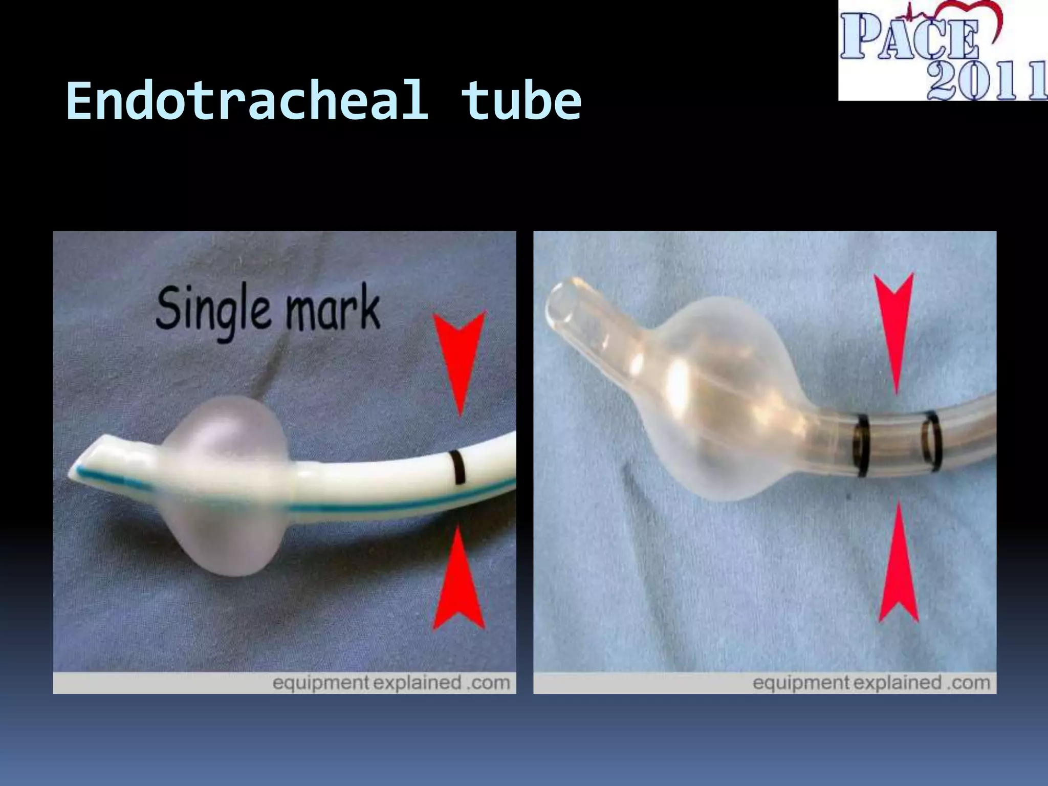 Endotracheal tube
 