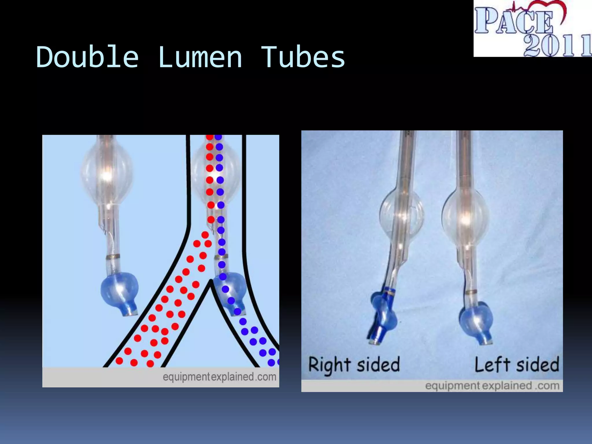Double Lumen Tubes
 