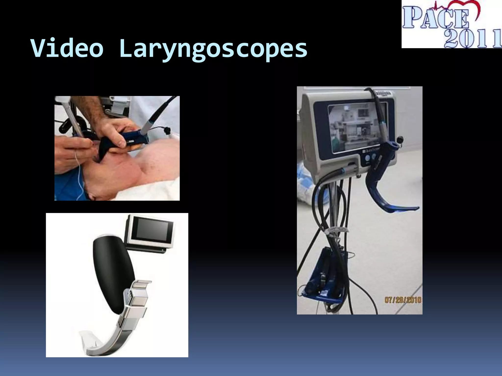 Video Laryngoscopes
 