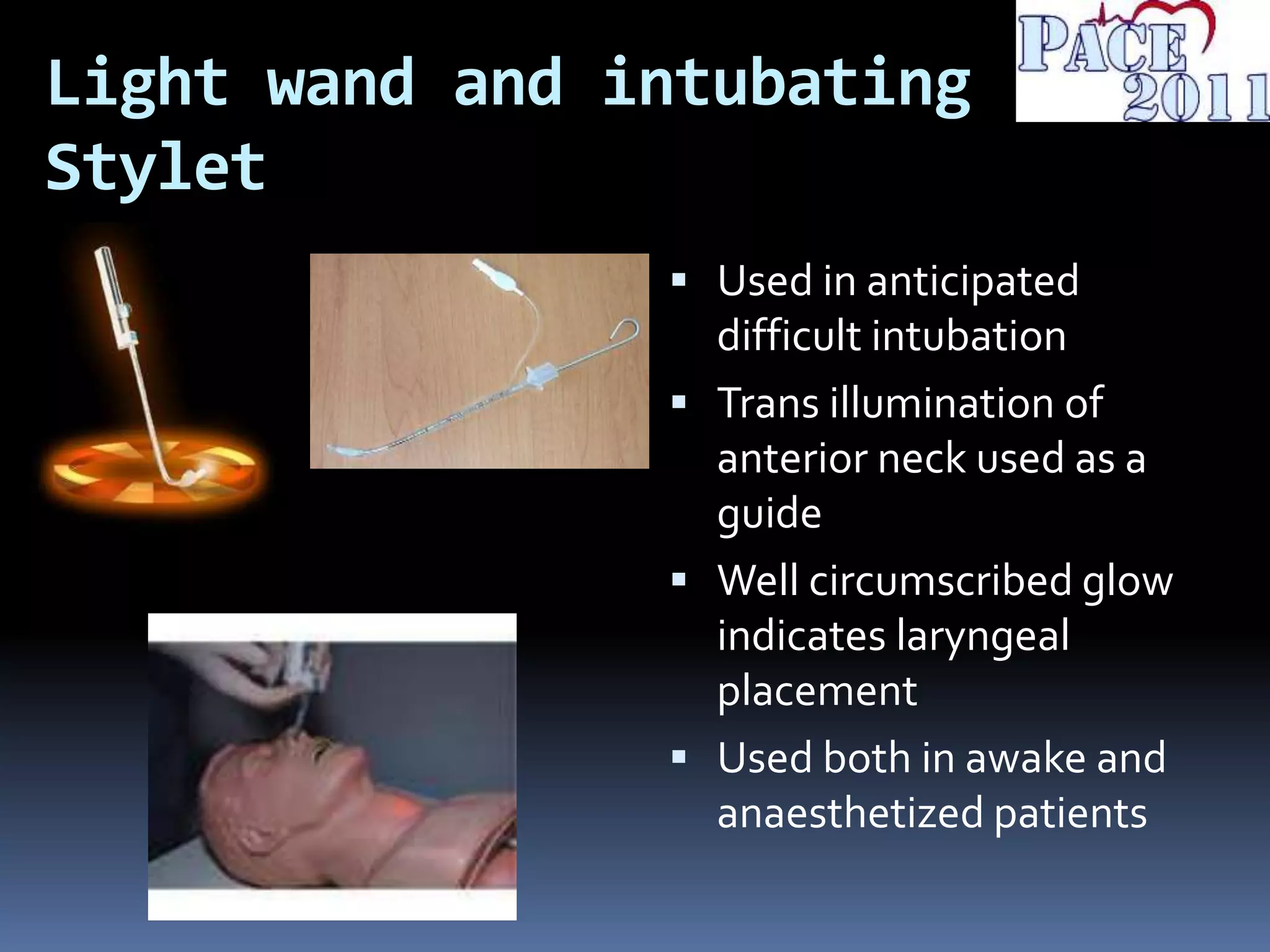 Light wand and intubating
Stylet
 Used in anticipated
difficult intubation
 Trans illumination of
anterior neck used as a
guide
 Well circumscribed glow
indicates laryngeal
placement
 Used both in awake and
anaesthetized patients
 