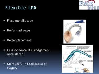 Flexible LMA
 Flexo metallic tube
 Preformed angle
 Better placement
 Less incidence of dislodgement
once placed
 More useful in head and neck
surgery
 