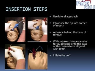 INSERTION STEPS
 Use lateral approach
 Introduce the tip into corner
of mouth
 Advance behind the base of
tongue
 Without exercising excessive
force, advance until the base
of the connector is aligned
with teeth.
 Inflate the cuff
 