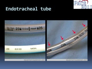 Endotracheal tube
 