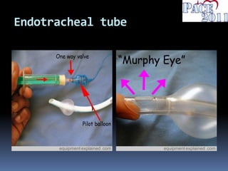 Endotracheal tube
 