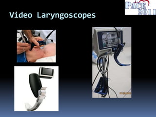 Video Laryngoscopes
 