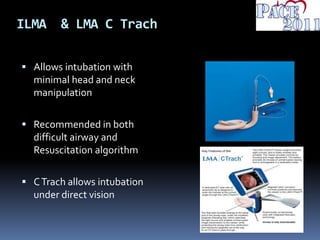 ILMA & LMA C Trach
 Allows intubation with
minimal head and neck
manipulation
 Recommended in both
difficult airway and
Resuscitation algorithm
 CTrach allows intubation
under direct vision
 