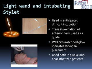Light wand and intubating
Stylet
 Used in anticipated
difficult intubation
 Trans illumination of
anterior neck used as a
guide
 Well circumscribed glow
indicates laryngeal
placement
 Used both in awake and
anaesthetized patients
 