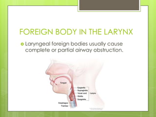 FOREIGN BODY IN THE LARYNX
 Laryngeal

foreign bodies usually cause
complete or partial airway obstruction.

 