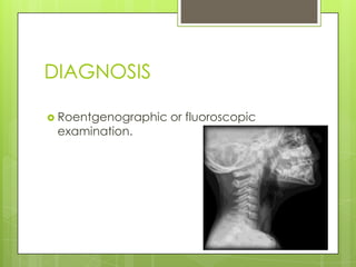 DIAGNOSIS
 Roentgenographic

examination.

or fluoroscopic

 