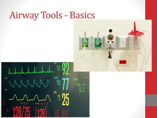 Airway Management for the Trauma Provider | PPTX