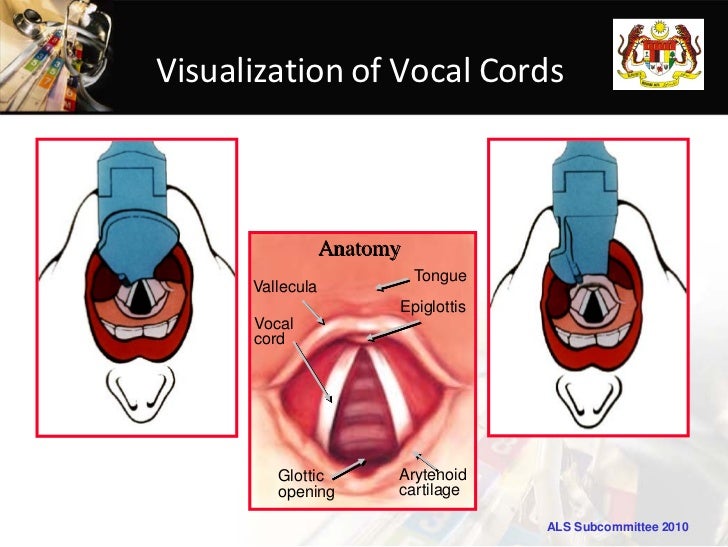 Airway lecture06122011