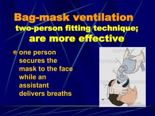 Bag-mask ventilation
two-person fitting technique;
are more effective
one person
secures the
mask to the face
while an
assistant
delivers breaths
 