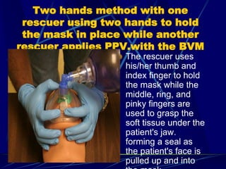 Two hands method with one
rescuer using two hands to hold
the mask in place while another
rescuer applies PPV.with the BVM
The rescuer uses
his/her thumb and
index finger to hold
the mask while the
middle, ring, and
pinky fingers are
used to grasp the
soft tissue under the
patient's jaw.
forming a seal as
the patient's face is
pulled up and into
 