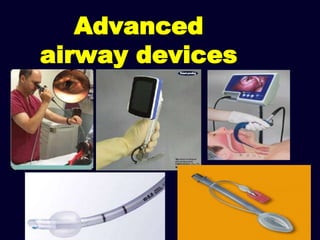 Advanced
airway devices
 