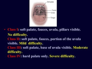 • Class I: soft palate, fauces, uvula, pillars visible.
No difficulty.
Class II: soft palate, fauces, portion of the uvula
visible. Mild difficulty.
Class III: soft palate, base of uvula visible. Moderate
difficulty.
Class IV: hard palate only. Severe difficulty.
 