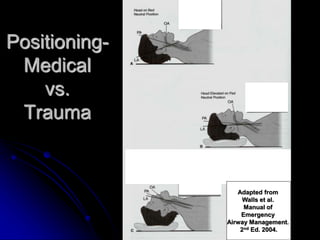 Positioning-
Medical
vs.
Trauma
Adapted from
Walls et al.
Manual of
Emergency
Airway Management.
2nd Ed. 2004.
 