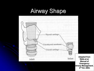 Airway Shape
Adapted from
Walls et al.
Manual of
Emergency
Airway Management.
2nd Ed. 2004.
 