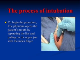 The process of intubation
 To begin the procedure,
The physician opens the
patient's mouth by
separating the lips and
pulling on the upper jaw
with the index finger
 
