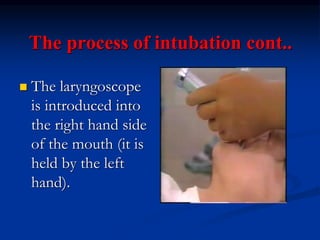 The process of intubation cont..
 The laryngoscope
is introduced into
the right hand side
of the mouth (it is
held by the left
hand).
 