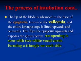 The process of intubation cont..
 The tip of the blade is advanced to the base of
the epiglottis, known as the vallecula, and
the entire laryngoscope is lifted upwards and
outwards. This flips the epiglottis upwards and
exposes the glottis below. An opening is
seen with two white vocal cords
forming a triangle on each side
 